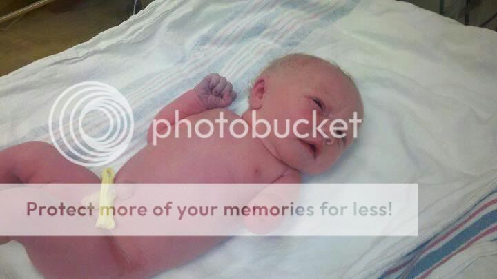 born without an arm... :( - BabyCenter